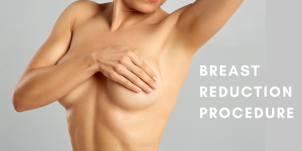 Breast reduction surgery in jaipur