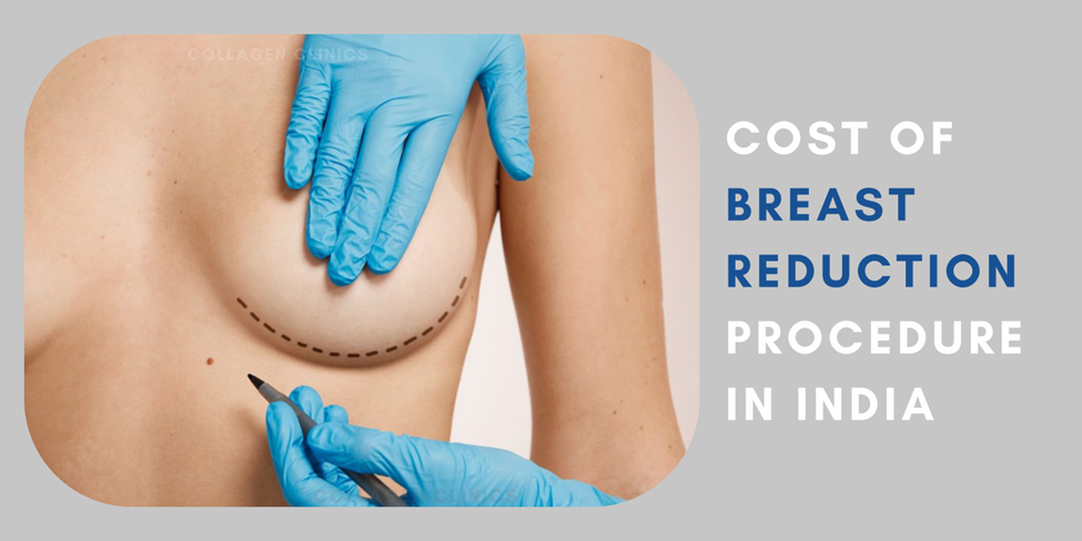 breast reduction cost in jaipur india