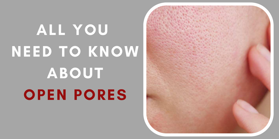 Open Pores Treatment in jaipur