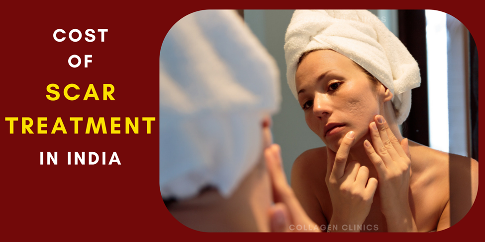 Scar treatment cost in Jaipur