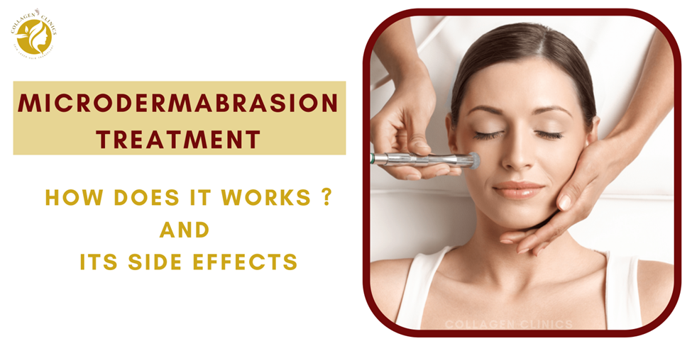 Microdermabrasion in Jaipur
