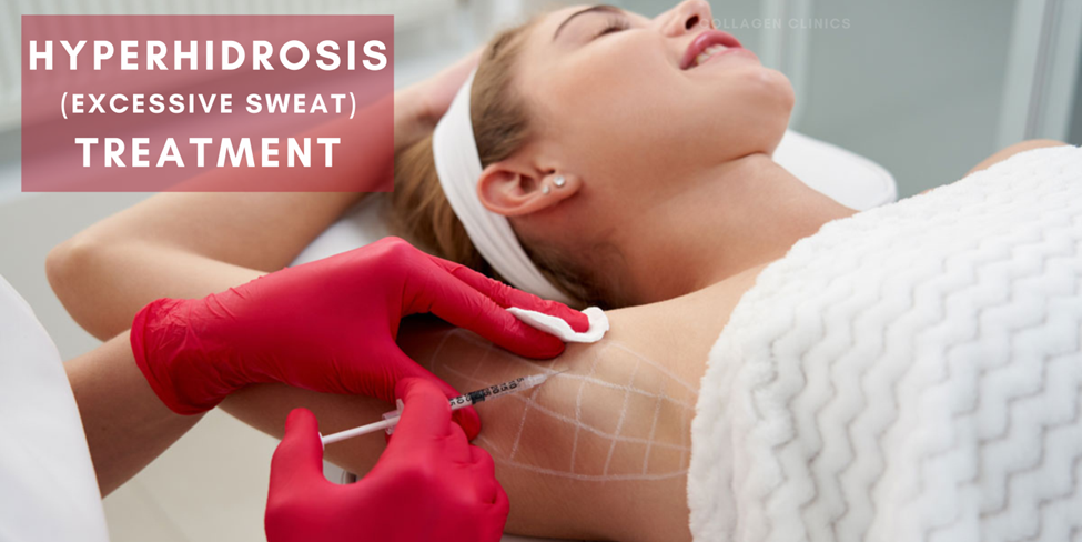hyperhidrosis treatment in jaipur