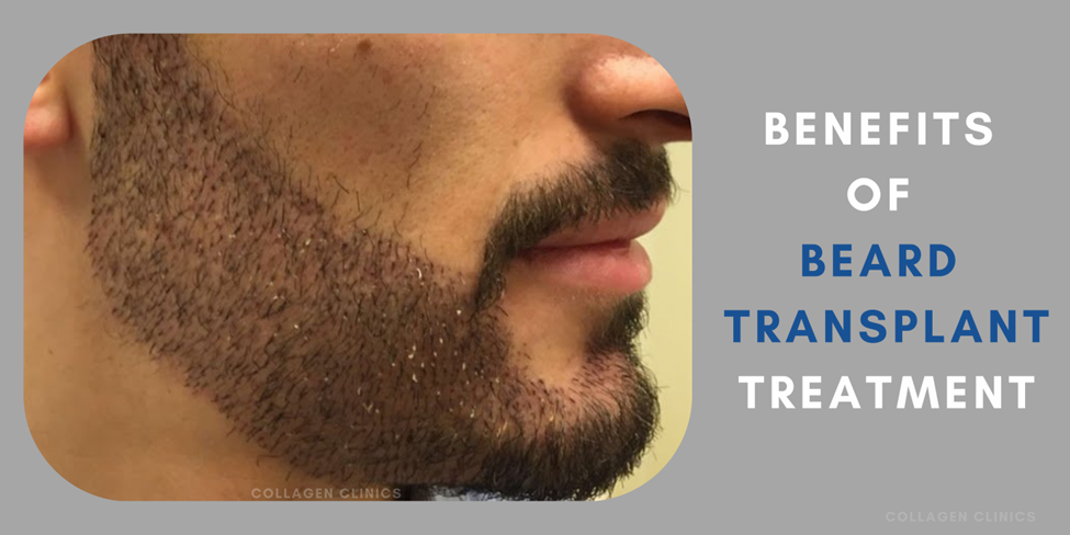 beard transplant in jaipur