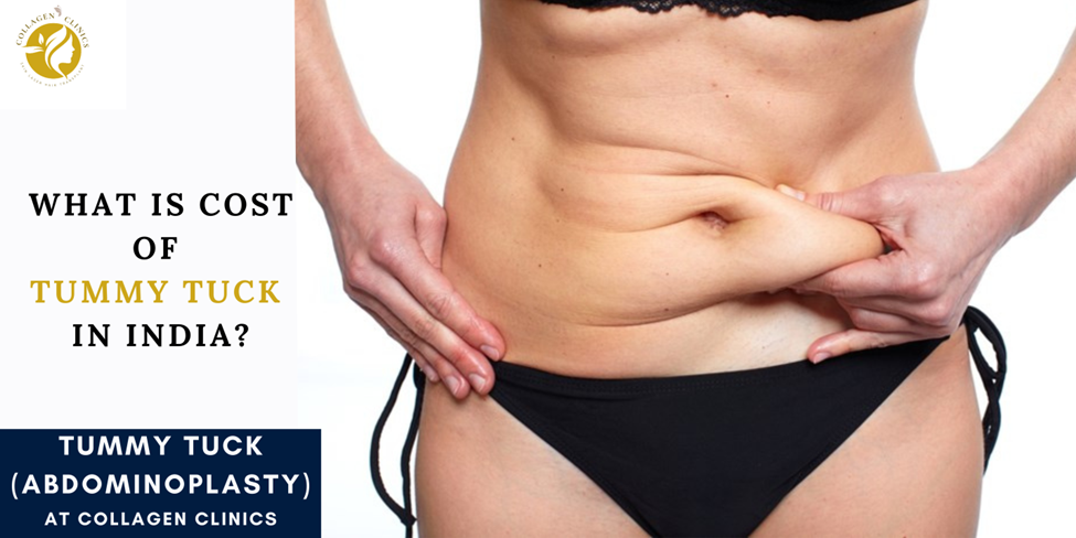 Tummy Tuck Surgery in Jaipur
