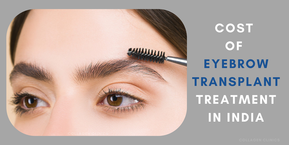 Eyebrow Hair Transplant Cost in Jaipur 