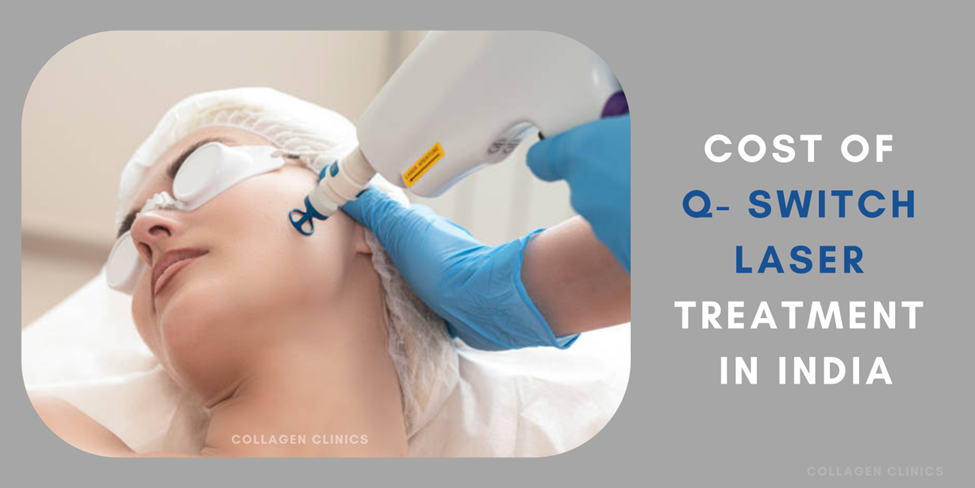 Q Switch Laser Treatment cost in Jaipur 