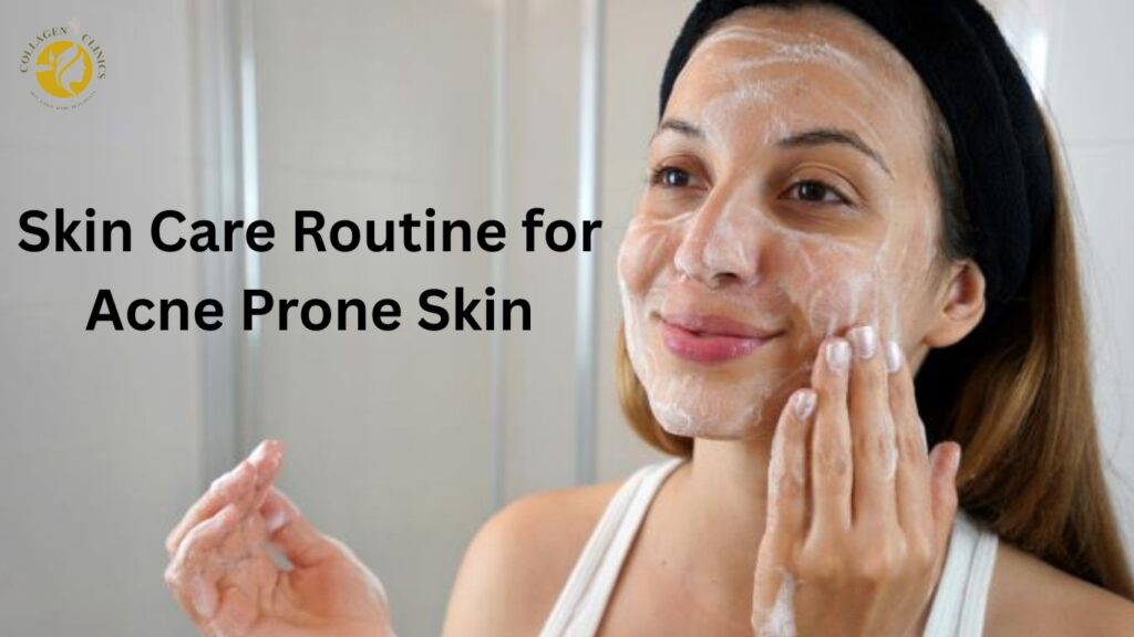 skin care routine for acne prone skin skin care routine for acne prone skin