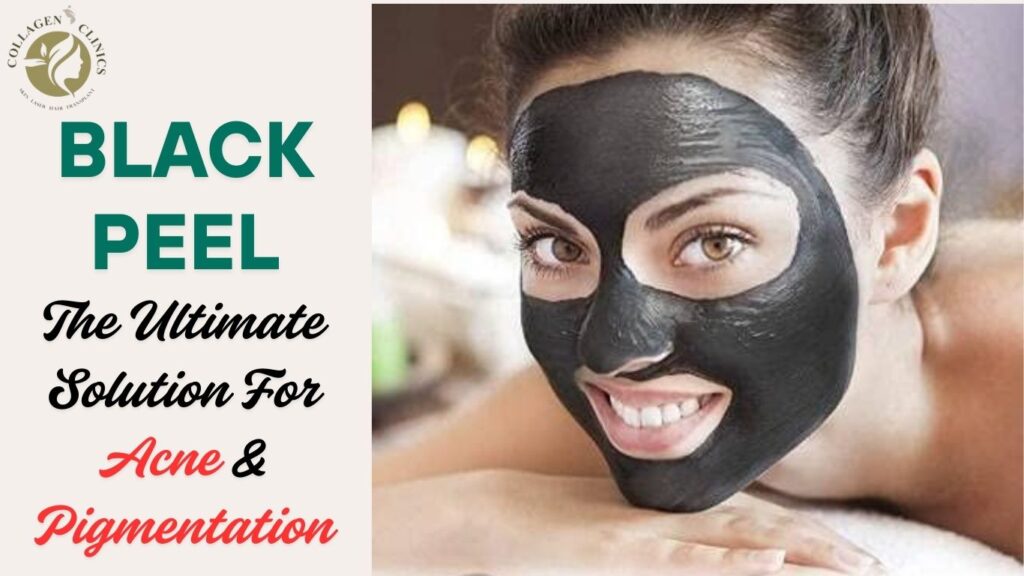 Black Peel in Jaipur