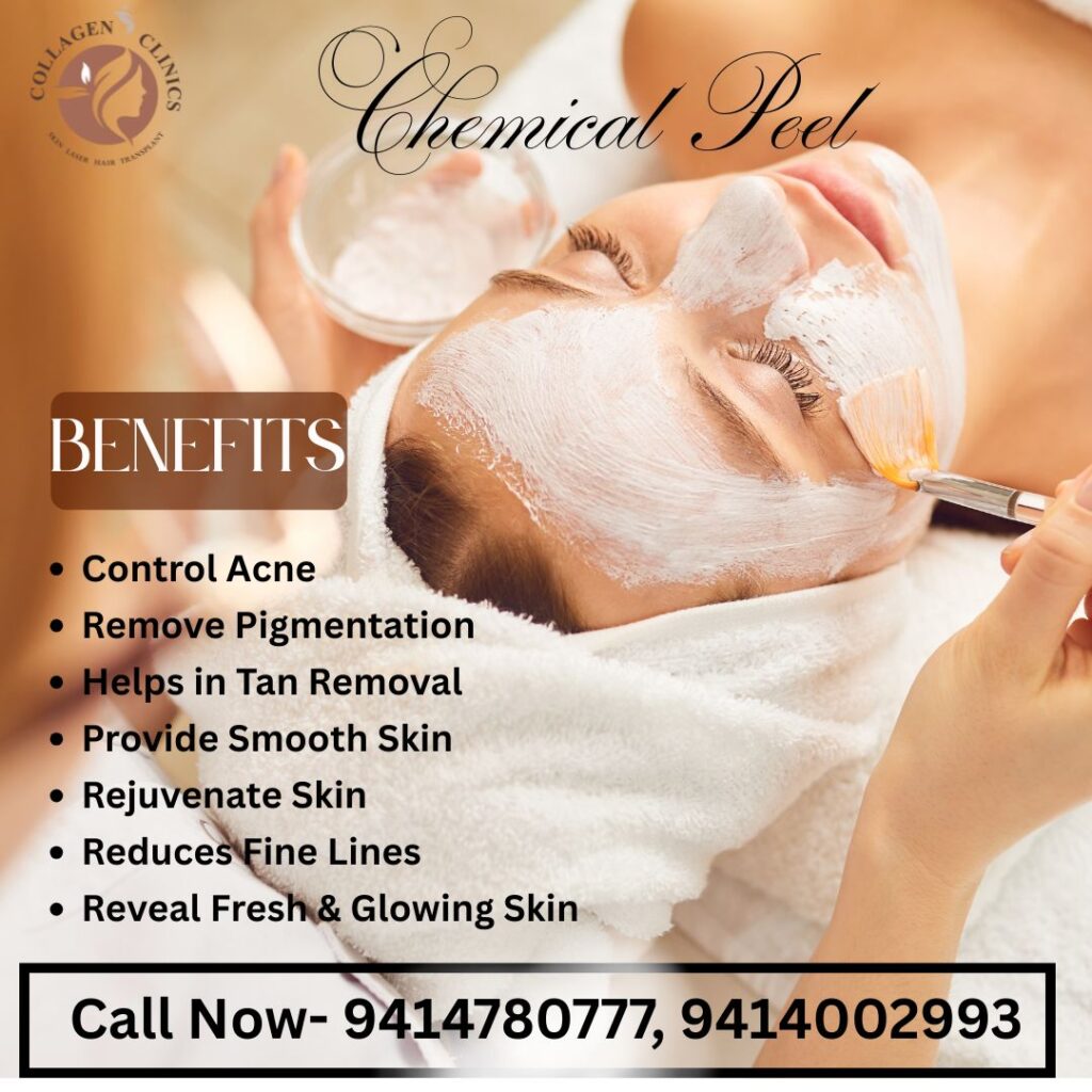 Best Chemical Peel Treatment in Jaipur